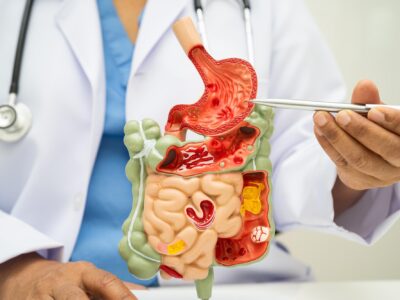 Endoscopia preventiva