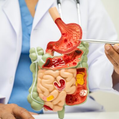 Endoscopia preventiva