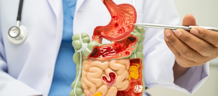 Endoscopia preventiva